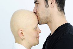 Seks w czasie chemioterapii