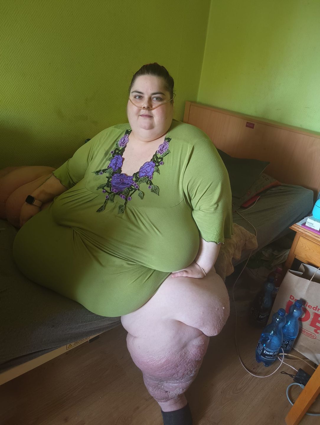 Anita Wasilewska, gdy ważyła 300 kg