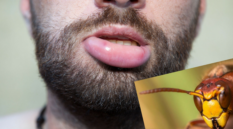 Szerszenie doprowadziły do śmierci mężczyzny. Alergia na jad - co warto wiedzieć?