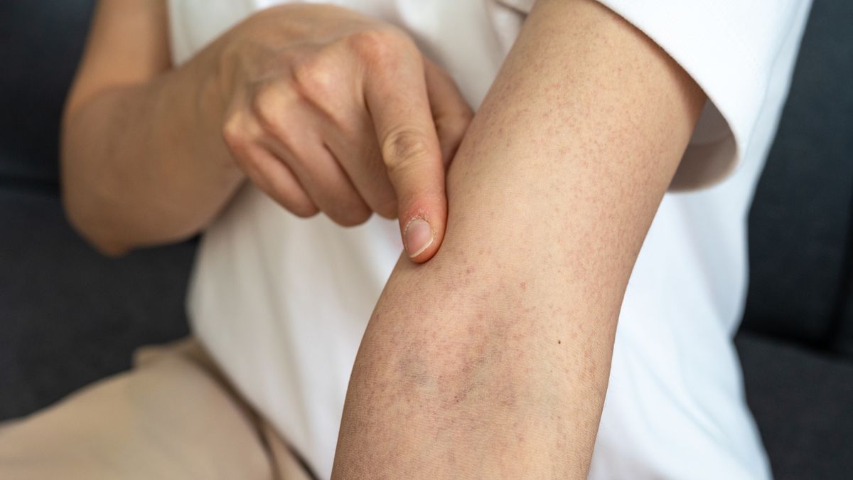 Niektóre problemy zdrowotne widać na skórze