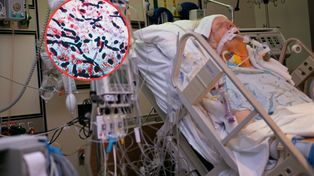 Nawet 100 tys. pacjentów rocznie. Zakażenia mogą prowadzić do sepsy