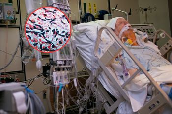 Nawet 100 tys. pacjentów rocznie. Zakażenia mogą prowadzić do sepsy