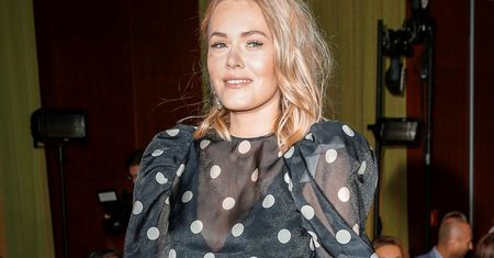 Magdalena Lamparska opublikowała mocne zdjęcie. Nie ma na nim włosów