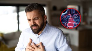 Nowe wytyczne ws. cholesterolu. Zmieniają podejście do profilaktyki