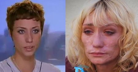 Top modelka zniszczona przez narkotyki! Z piękności zmieniła się w potwora!