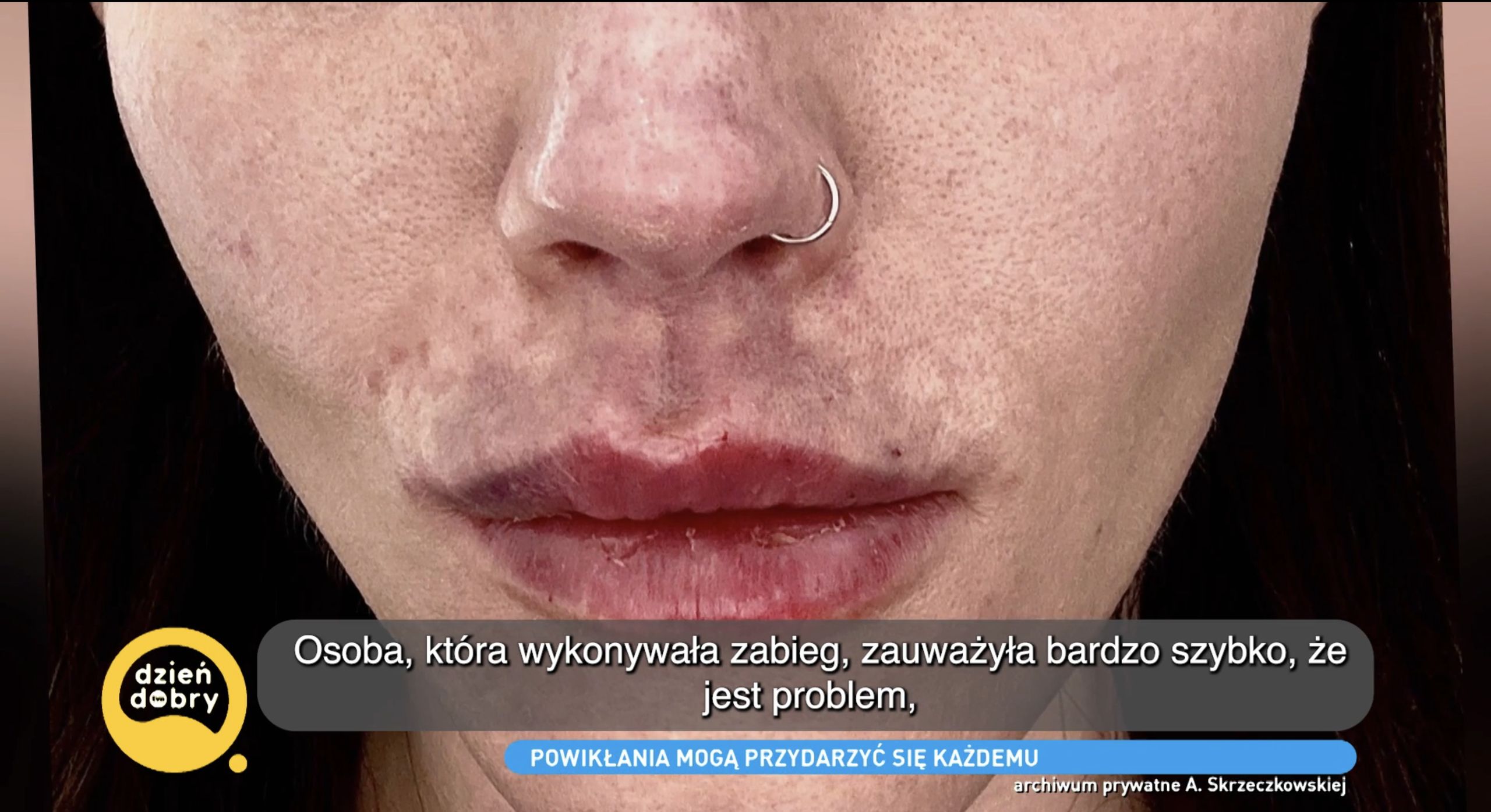 Gwiazda "Top Model" przeżyła chwile grozy