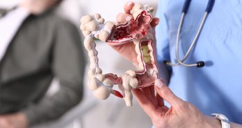 Koniec z wyniszczającą chemią? Guz jelita stopniał po 9 tygodniach leczenia
