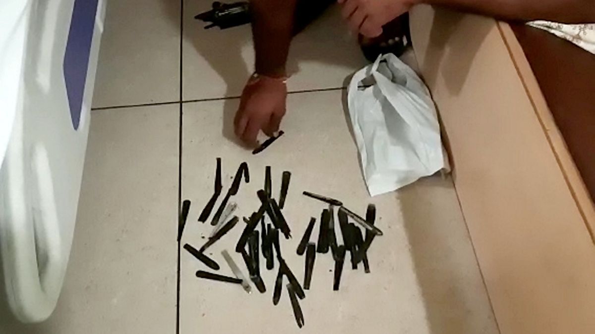 Doctors had to remove 63 spoons 