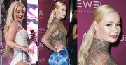 Iggy Azalea powiększyła pupę? Chirurg: "To typowy efekt brazylijskich implantów"