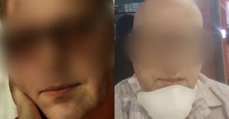 Wielka Brytania. Zgolił włosy i brwi. Polak udawał chorego na białaczkę