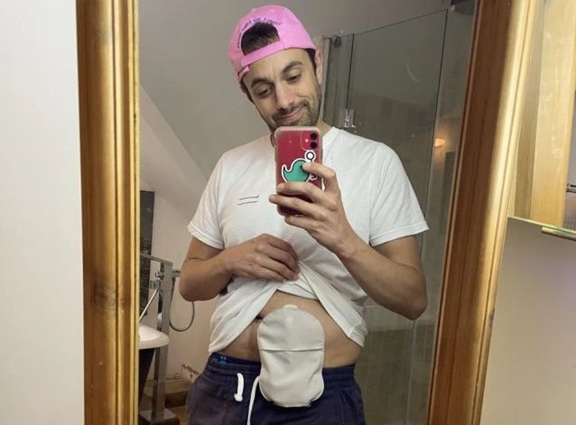 33-latek opowiada o objawach raka jelita grubego