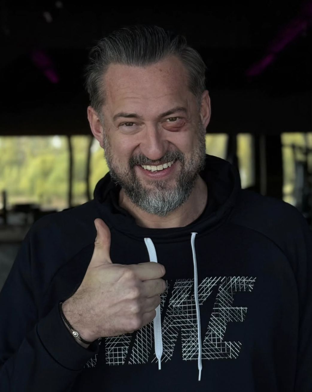 Marcin Prokop z podbitym okiem