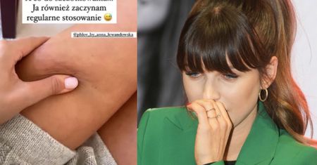 Anna Lewandowska ściska udo i pokazuje fankom, że TEŻ MA CELLULIT!