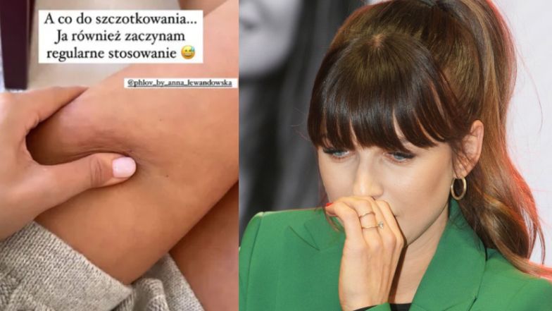 Anna Lewandowska ściska udo i pokazuje fankom, że TEŻ MA CELLULIT!