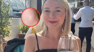 Po alkoholu bolała ją szyja. Badania wykryły nowotwór