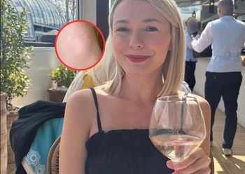 Po alkoholu bolała ją szyja. Badania wykryły nowotwór