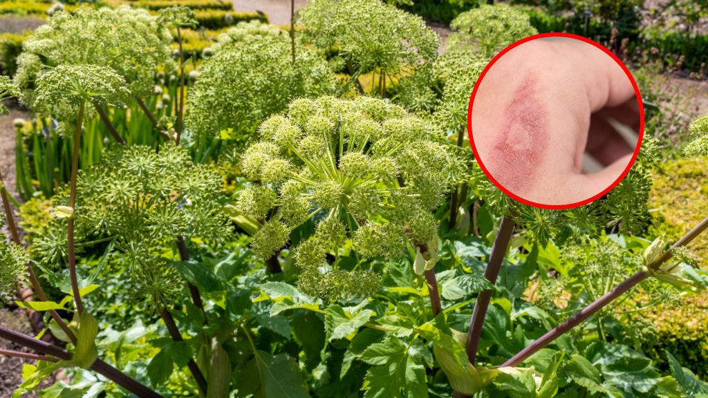 Latem uważaj na te zioła i olejki. Prosta droga do oparzeń