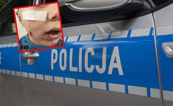 Pies pogryzł 4-latka. Właściciel uciekł, ale został złapany