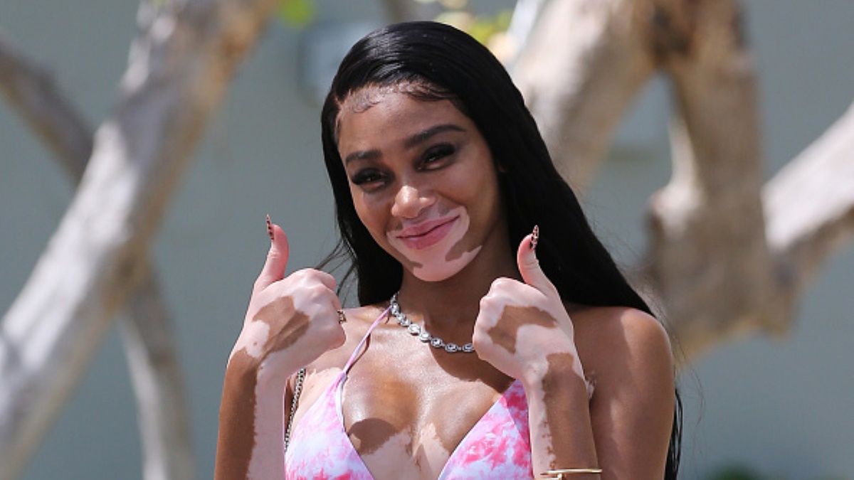 Winnie Harlow wybrała się na spacer, mając na sobie jedynie różowe bikini oraz cenną biżuterię