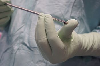 Zoperowali 30-latce zdrowy odcinek kręgosłupa. Dostała zadośćuczynienie