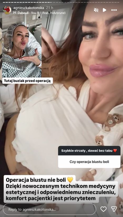 Agnieszka Kotońska o operacjach plastycznych