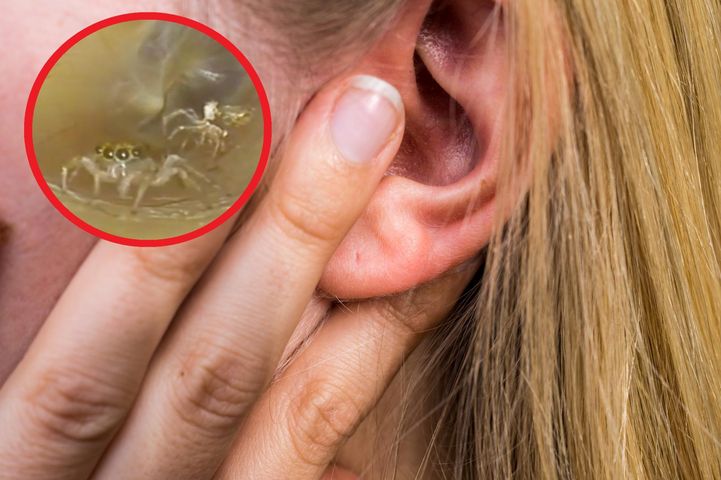 Kobieta skarżyła się na "szeleszczenie" w uchu. Lekarze znaleźli intruza w kanale słuchowym