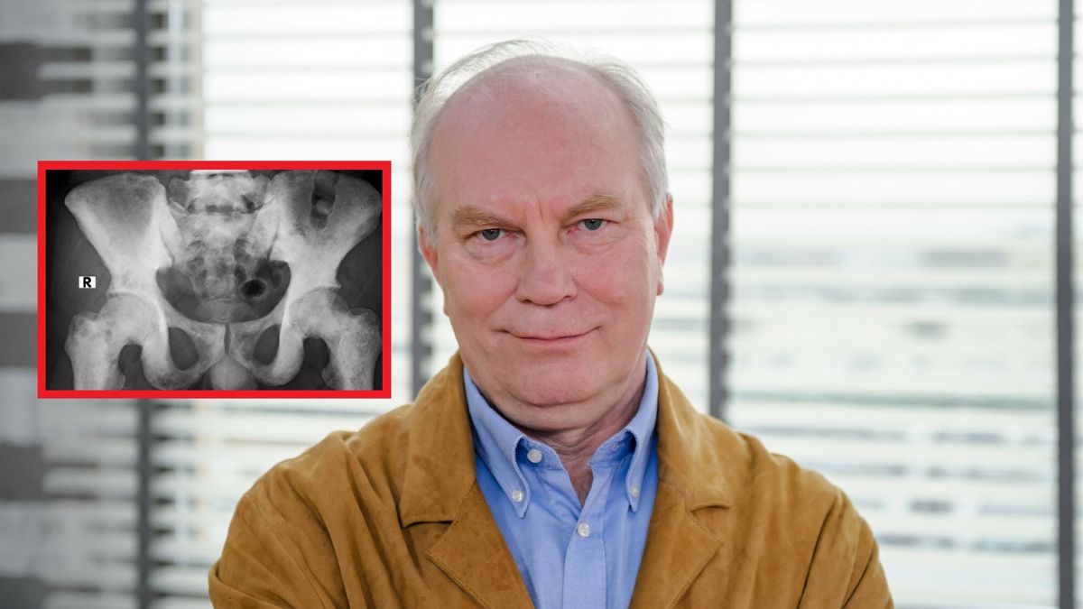 Prof. Szczylik usłyszał diagnozę raka prostaty