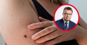 "Czerniakowe abecadło". Złośliwy nowotwór skóry rozwija się po kryjomu