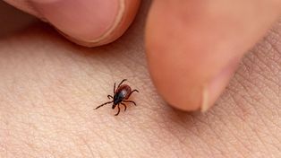 Wielkopolska: Plaga kleszczy. Już ponad tysiąc zachorowań na boreliozę