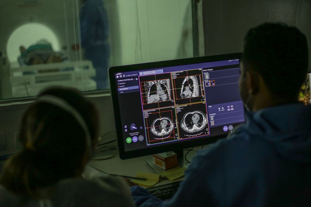 COVID uruchamia kaskadę zmian zapalnych