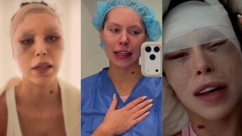 Julia von Stein zapowiada nowy film i pokazuje się po DRUGIEJ OPERACJI twarzy. "Ja nie mam już k*rwa siły"