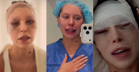 Julia von Stein zapowiada nowy film i pokazuje się po DRUGIEJ OPERACJI twarzy. "Ja nie mam już k*rwa siły"