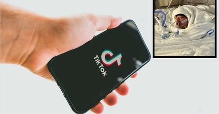 Nastolatek wziął udział w wyzwaniu na TikToku. Ma poparzone 80 proc. ciała