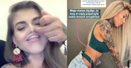 Deynn kompromituje się na Instagramie. Twierdzi, że blizna na jej nodze to efekt... poparzenia ciążowego brzucha jej mamy (FOTO)