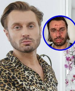 Pobito go i okradziono. Co zrobiła policja?