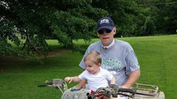 Przeszczep twarzy, dzięki któremu zyskał nowe życie