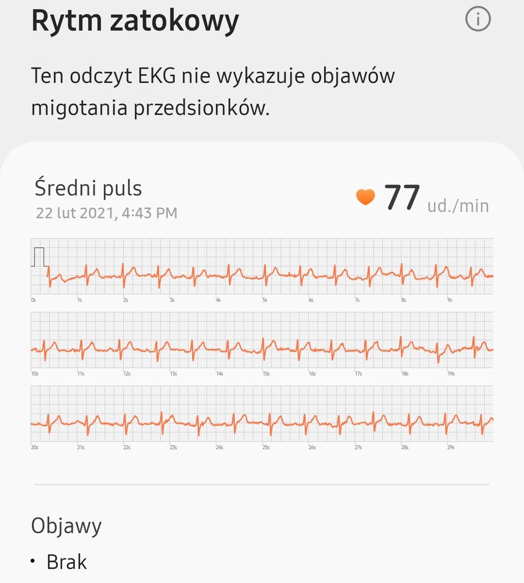 Tak wygląda przykładowy wynik EKG
