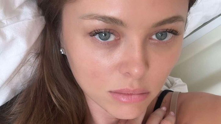 Joanna Opozda pokazała spuchniętą nogę po zdjęciu opatrunku