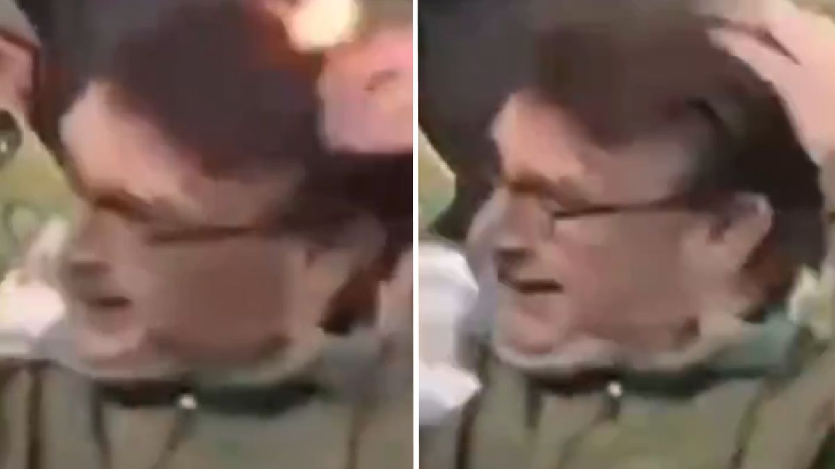 Włosy kibica stanęły w ogniu na meczu Celticu z Hibernian