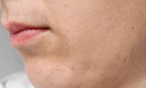 Usuwa kobiecy wąsik. Jest w każdym sklepie i kosztuje grosze