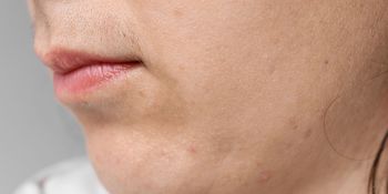 Usuwa kobiecy wąsik. Jest w każdym sklepie i kosztuje grosze