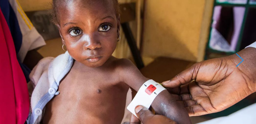 Dzieci umierają z głodu w Afryce