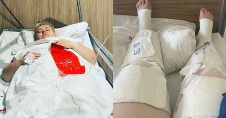 Kinga Zawodnik pokazała zdjęcia PO OPERACJI zmniejszenia żołądka. "Dużo bólu się wycierpiałam i chciałabym zapomnieć" (FOTO)