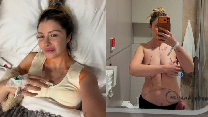 Ciocia Liestyle przeszła redukcję biustu w ramach barteru