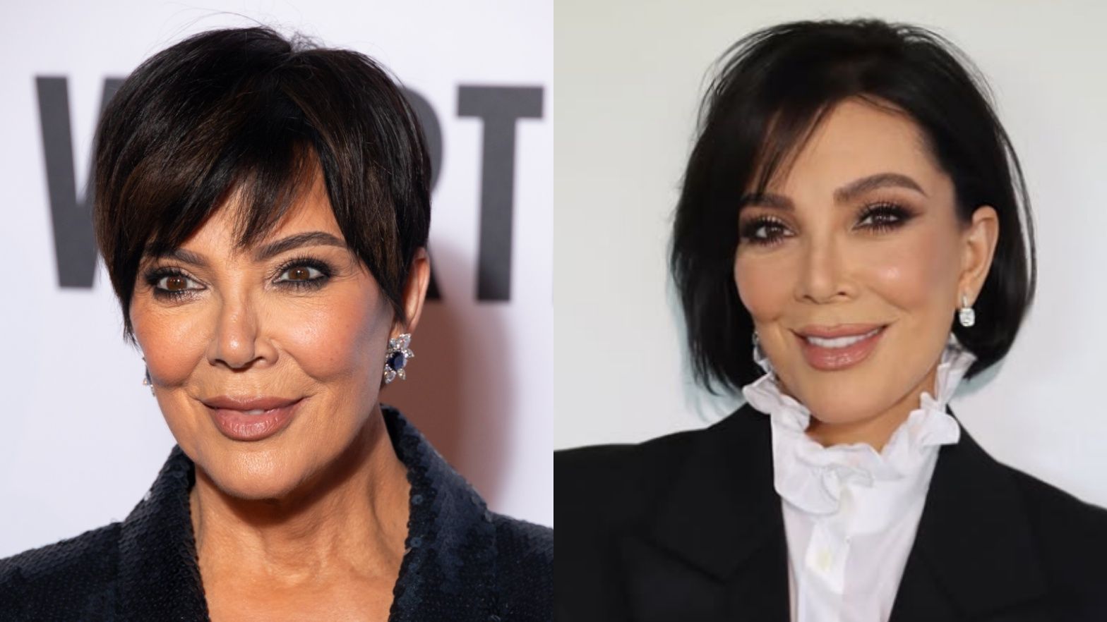 Kris Jenner przed i po liftingu