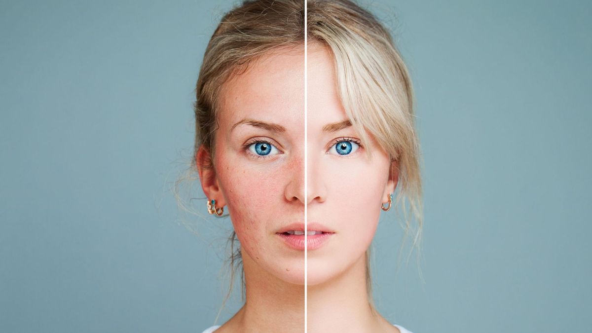 Medycyna estetyczna – starsza i jeszcze bardziej wyrafinowana… W tym roku obchodzi swoje  25-lecie!