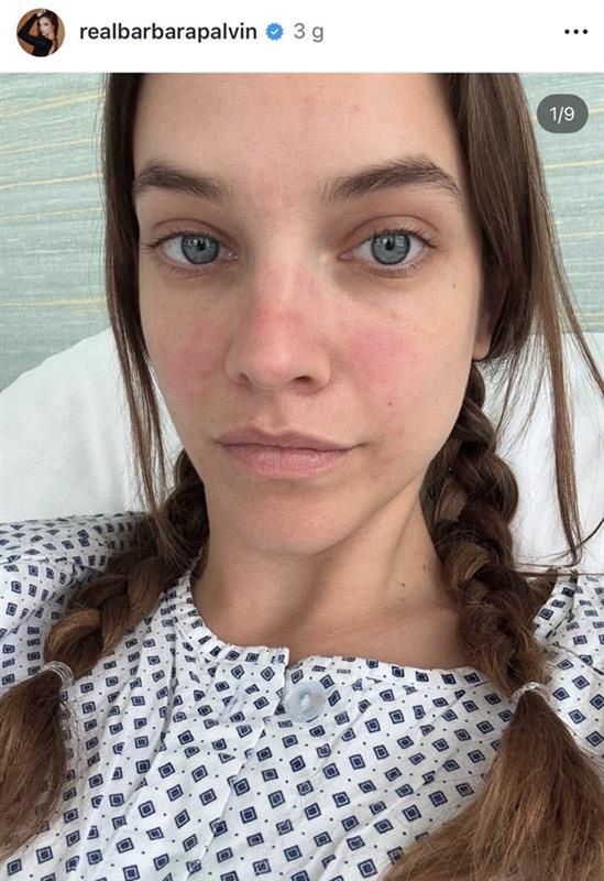 Barbara Palvin choruje na endometriozę