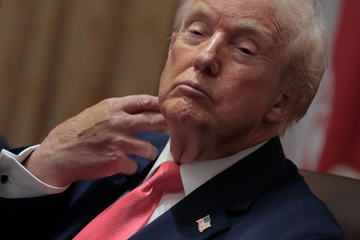 Trump nie słucha lekarzy. Robi to od 30 lat