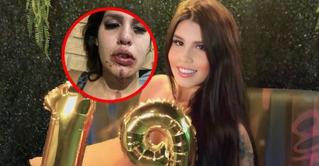 Imprezowała z influencerami. Brazylijka pokazała, co jej zrobili
