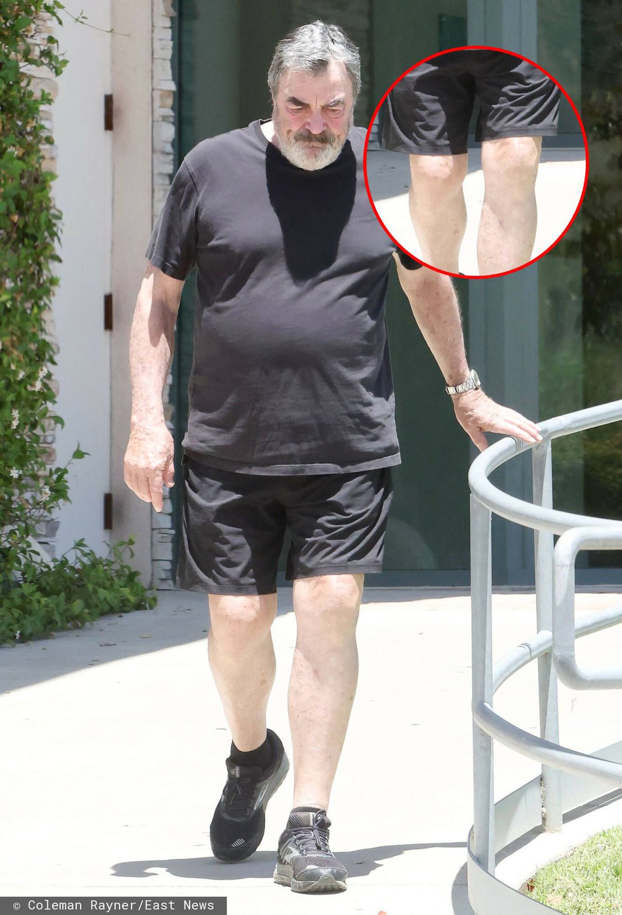 Tom Selleck in the recent photos, has visible vertical scars on his knees